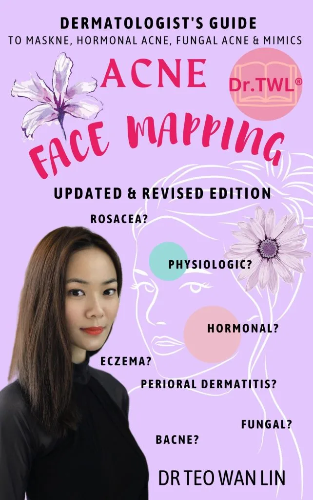 Acne Face Mapping